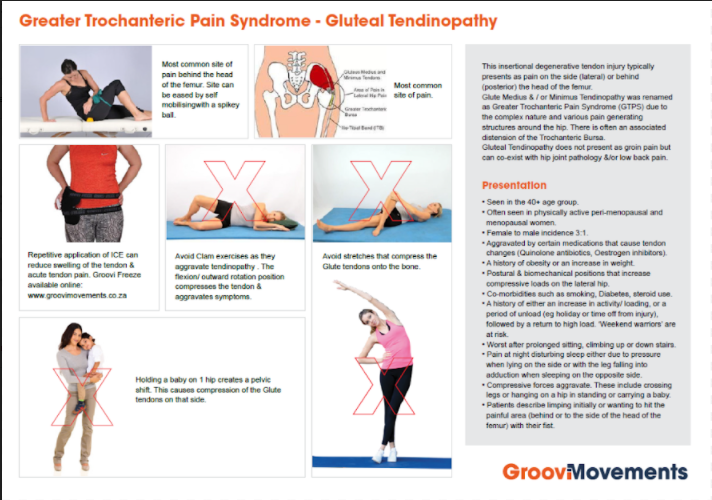Differentiating Buttock Pain Gluteal Tendinopathy Open Data