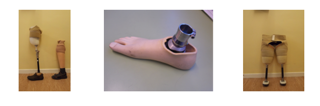 File:Amputee (foot).png