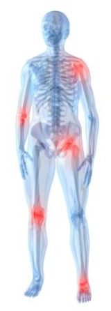 File:Pain areas.jpg
