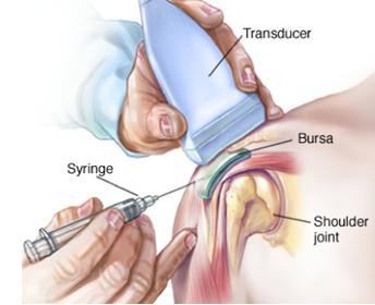 File:Bursa US guided injection.png