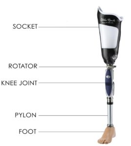 File:AKparts-of-a-prosthesis-268x300.jpg
