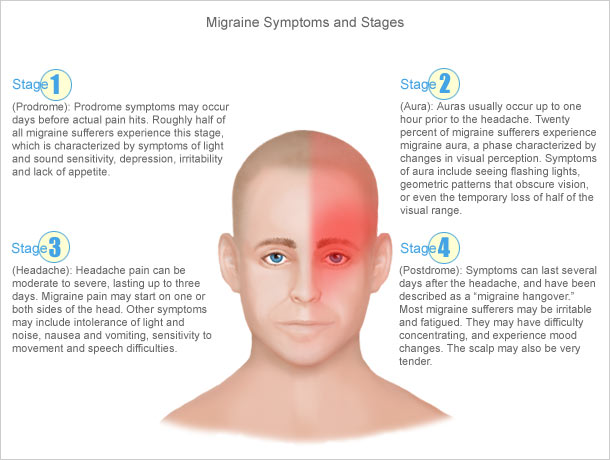 Stages of A Migraine