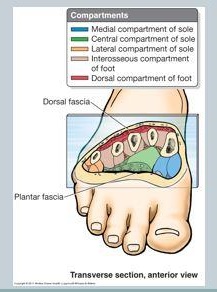 lateral compartment syndrome