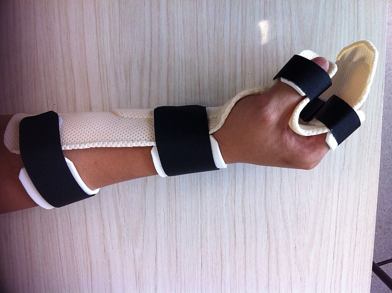 Introduction to Upper Limb Orthoses - Physiopedia
