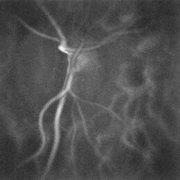 File:Laser Doppler holography of blood flow in the optic nerve head region of the human retina.gif