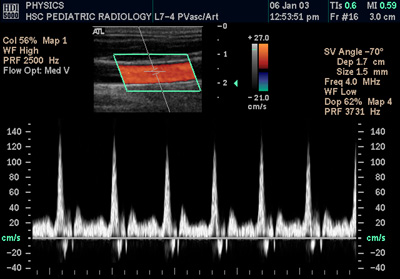File:Doppler ultrasound.jpg