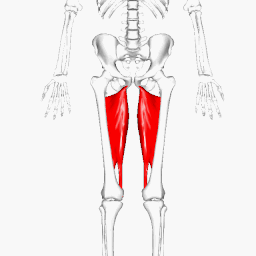 Posterior aspect of thighs and calves of the patient, 48 hours