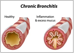 bronchiolitis pathology