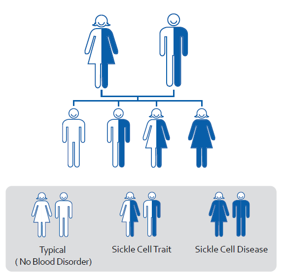 File:Sickle Cell Anemia inheritance model.jpg