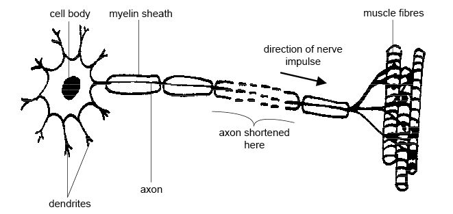File:Motor neuron.jpg