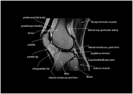 File:Anatomy of the knee.png