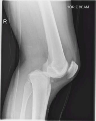 File:Knee dislocation1.jpg