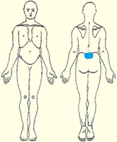 File:Spondylolysis Body Chart.jpg