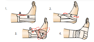 File:Ankle Taping.png