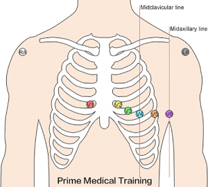 File:12 lead ecg placement.png