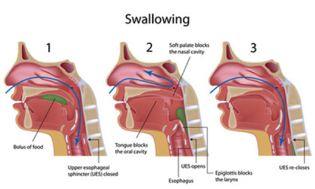 chin tuck swallow