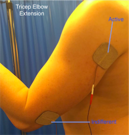 https://www.physio-pedia.com/images/a/a5/Elbow_Extension_Motor_Control_.png