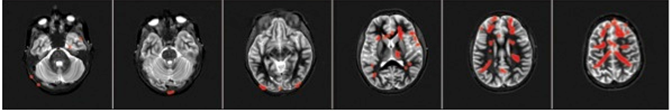 File:FMRI row 3.png