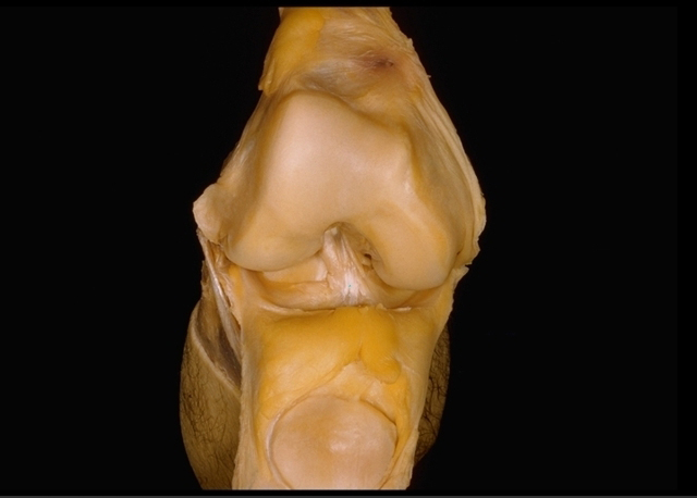 File:Condyles of femur with cruciate ligaments LD.B.0190.005.L.jpg