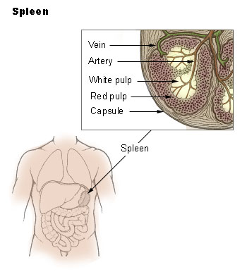 Ruptured spleen  Beacon Health System
