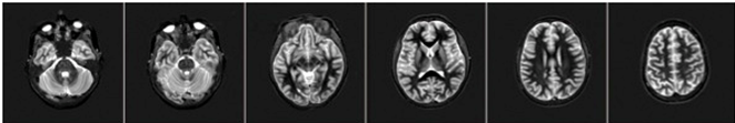 File:FMRI row 1.png