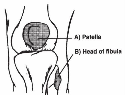 Areas of interest when palpating for the Ottawa Knee Rules