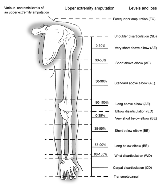 Upper Limb Considerations - Physiopedia