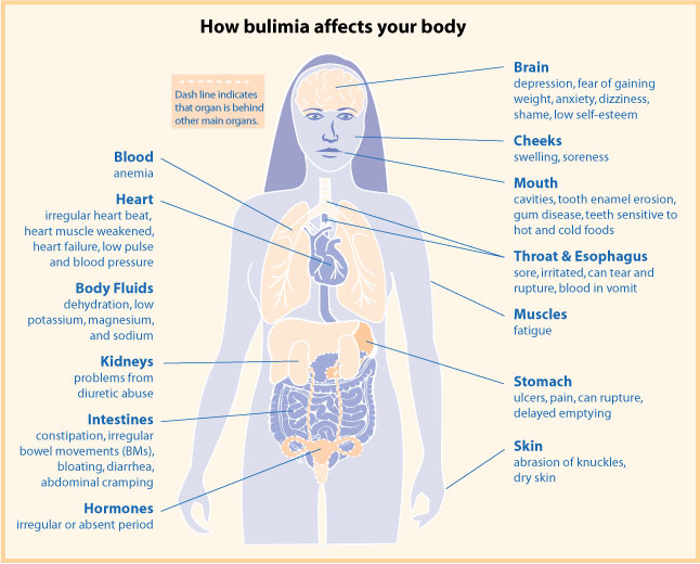 bulimia effects on body