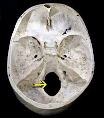 Yellow arrow indicates the foramen magnum.