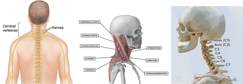 Cervical Placement for Neck Issues Example 