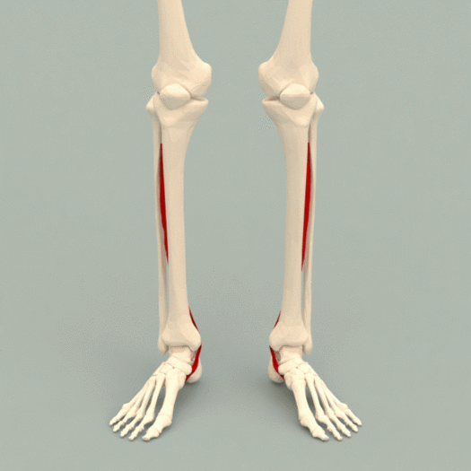 Posterior Tibial Tendon Dysfunction Physiopedia 2442