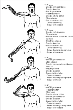 Upper Limb Tension Tests (ULTTs) - Physiopedia