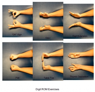 Ulnar Impaction Syndrome - Physiopedia