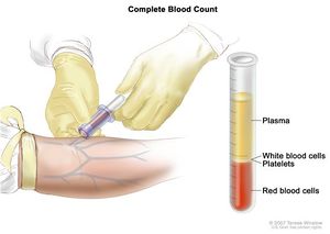 MM Blood Test.jpg
