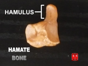 Hamate bone - Hamulus.png