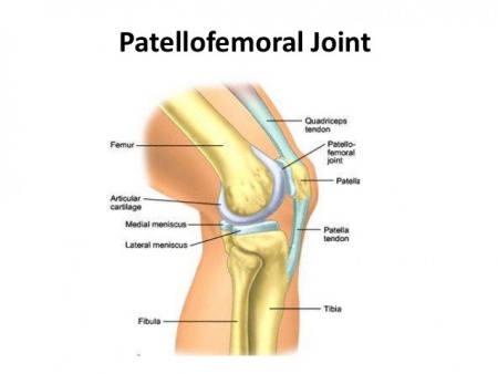 Patellofemoral Joint Physiopedia