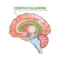 The area in green denotes the corpus callosum