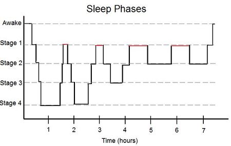 Graph showing the passage through the four principle phases of sleep over the course of a night. Portions marked in red indicate REM sleep
