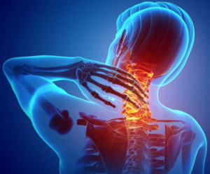 The Solution to Back and Neck Pain - Chiro Plus Rehab