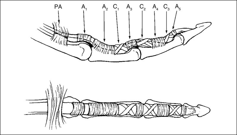File:Flexor pulley anatomy.jpeg