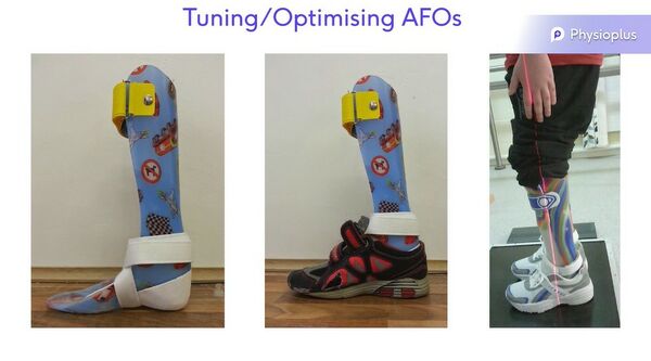 Push Ortho Ankle Foot Orthosis (AFO) : lightweight foot support