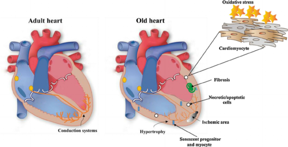 Cardiovascular disease - Ventricular Dysfunction, Heart Failure, Treatment