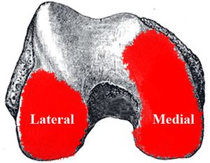 Articular surface paradox of femur
