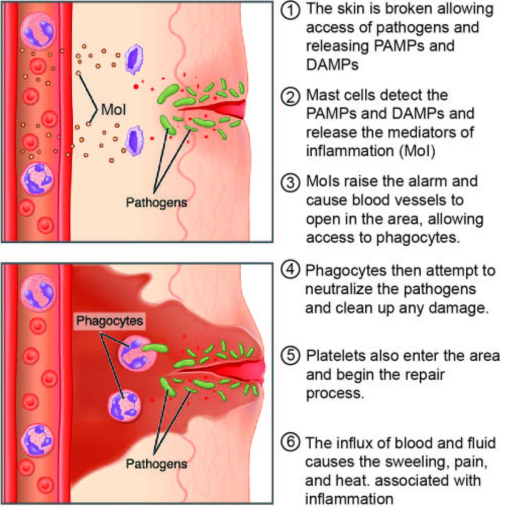 inflammation-acute-and-chronic-physiopedia