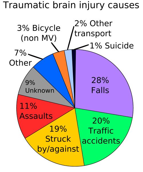 File:2000px-TBI causes chart svg.png