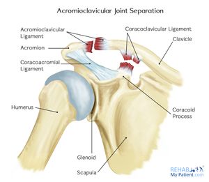 Acromioclavicular Joint Disorders - Physiopedia