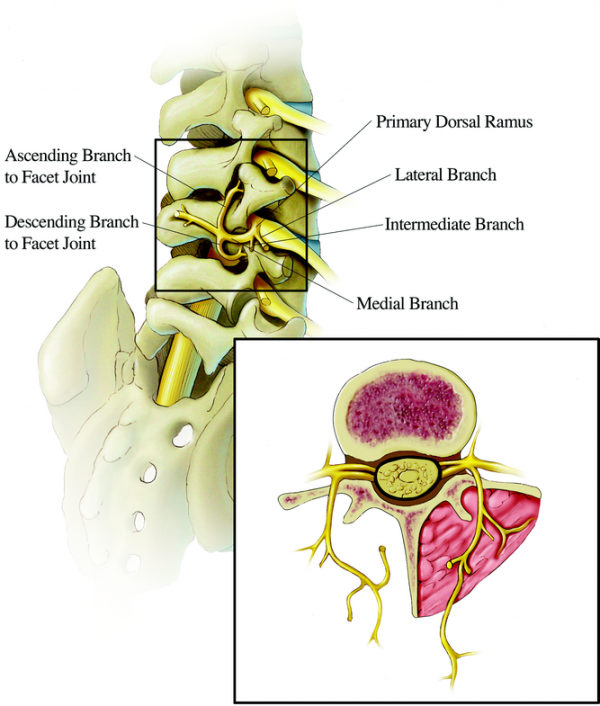 Lumbar Facet Syndrome - Physiopedia