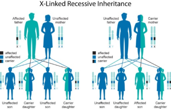 Haemophilia - Physiopedia