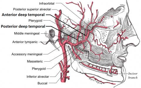 Temporal Arteritis (Giant Cell Arteritis) - Physiopedia