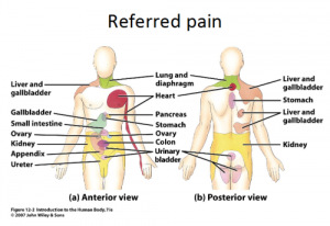 Referred Pain Physiopedia